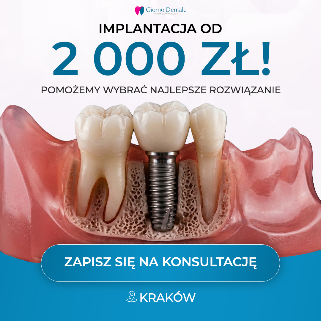 Implantacja zęba