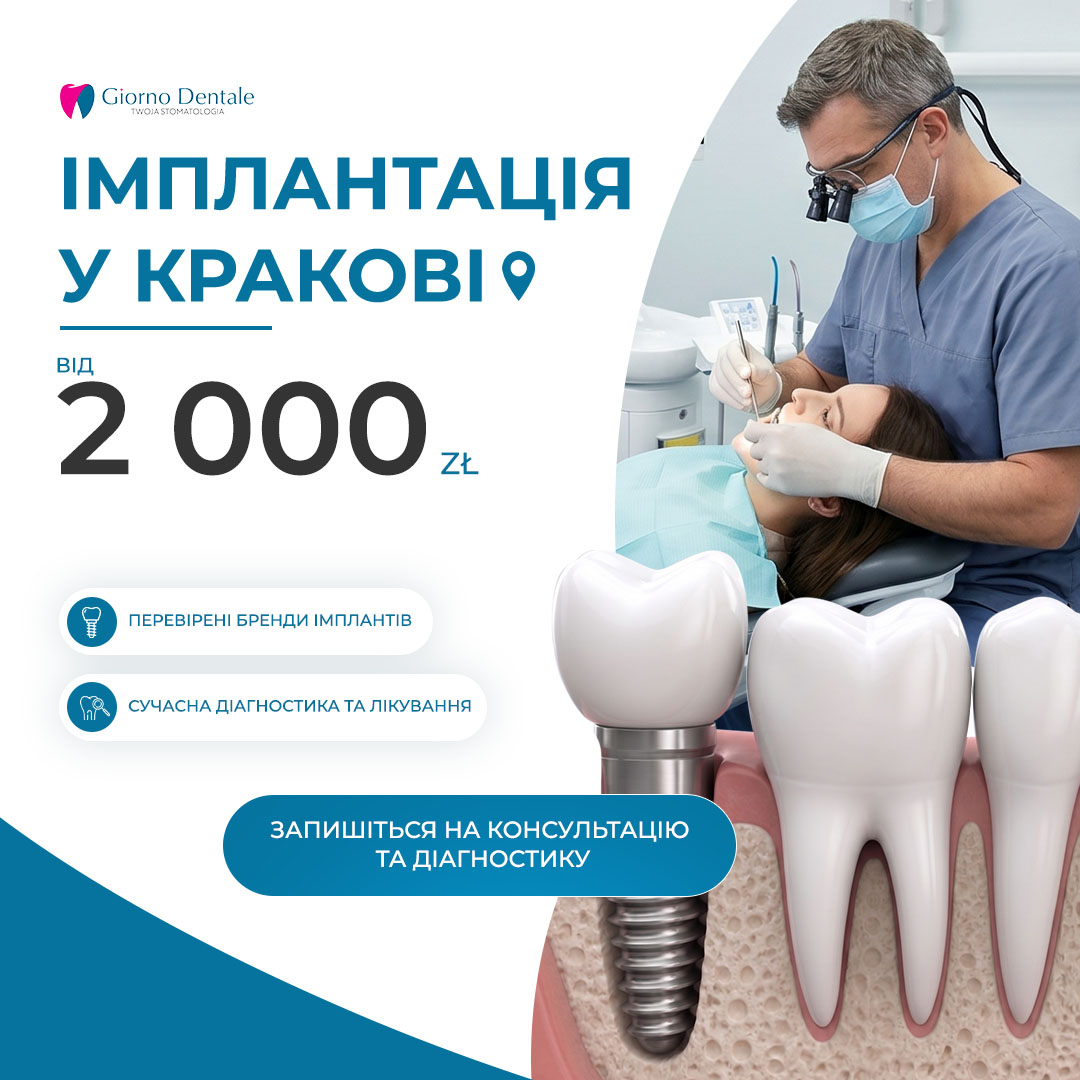 Імплантація зуба